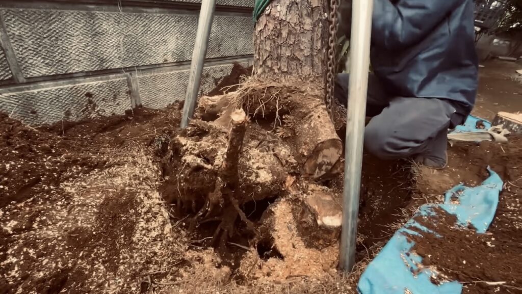 抜根費用